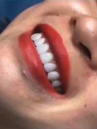 外貌哪都美了
怎能输在一口牙齿上呢
高贵气质美女标配：唇红齿白[让我看看]#美牙