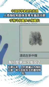 中国科学家研究发现人类指纹和肢体发育有基因关联，手指斗纹越多，小指越长。