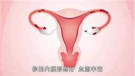 子宫内膜薄就一定不能怀孕吗？生殖医生有话说，助你迎好“孕”