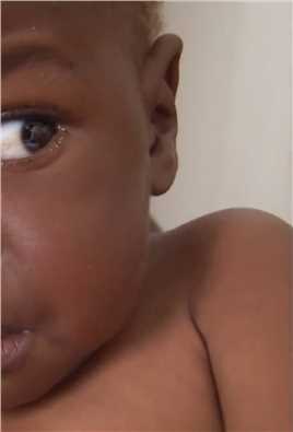 3个月大婴儿感染艾滋病，父母也相继离世，这一家人发生了什么？#纪录片#非洲贫穷儿童