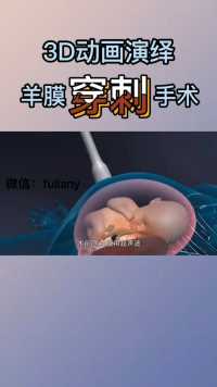 胚胎羊膜穿刺。这个一般是高龄产妇或者有遗传病基因的会做这个检查。