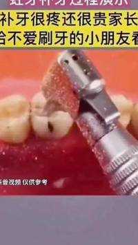 补牙很疼还很贵，家长们给不爱刷牙的小朋友看#u型牙刷 #口腔健康