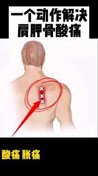 肩胛骨酸痛，做这个动作可以有效缓解